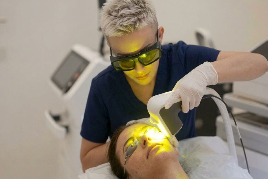 Tretman Yellow (žutim) laserom u ordinaciji Dr Marije Bošković.